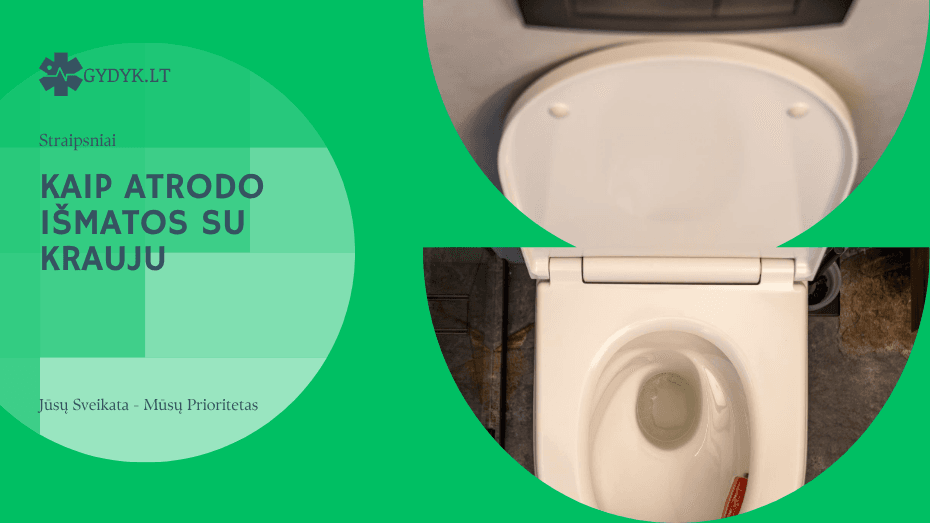 Kaip atrodo išmatos su krauju