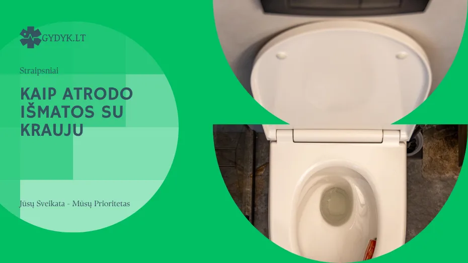Kaip atrodo išmatos su krauju
