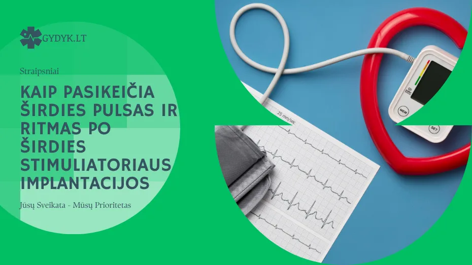 Kaip pasikeičia širdies pulsas ir ritmas po širdies stimuliatoriaus implantacijos Kaip pasikeičia širdies pulsas ir ritmas po širdies stimuliatoriaus implantacijos