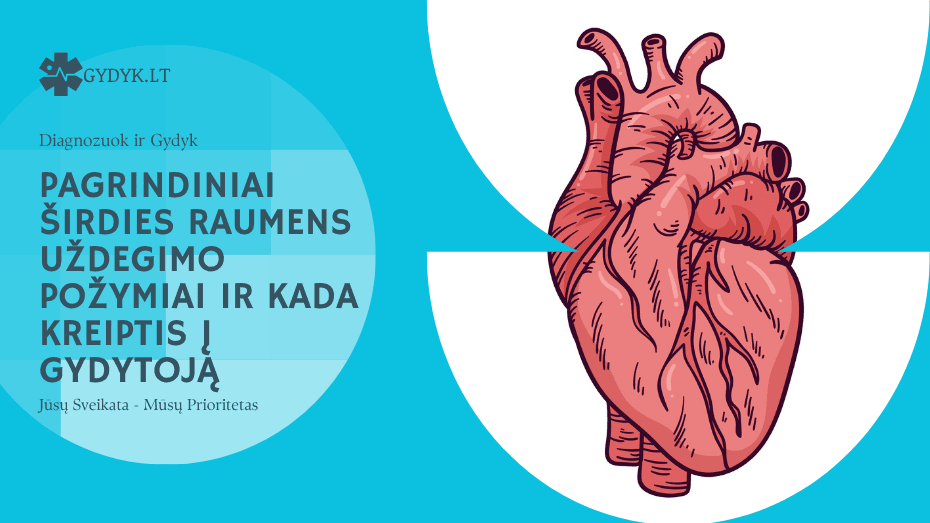 Pagrindiniai širdies raumens uždegimo požymiai ir kada kreiptis į gydytoją
