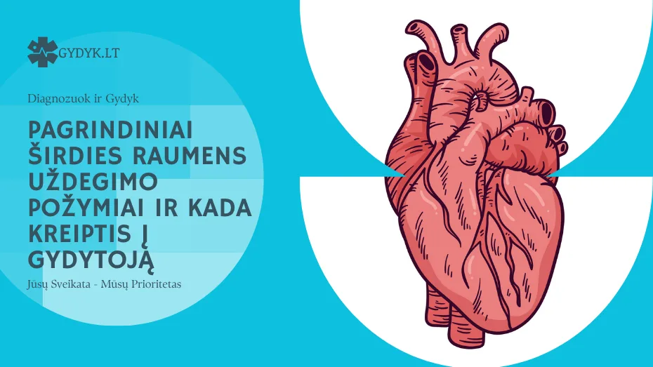 Pagrindiniai širdies raumens uždegimo požymiai ir kada kreiptis į gydytoją