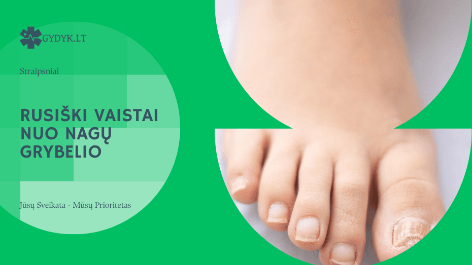 Rusiški vaistai nuo nagų grybelio
