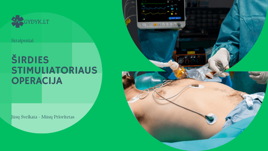Širdies stimuliatoriaus operacija