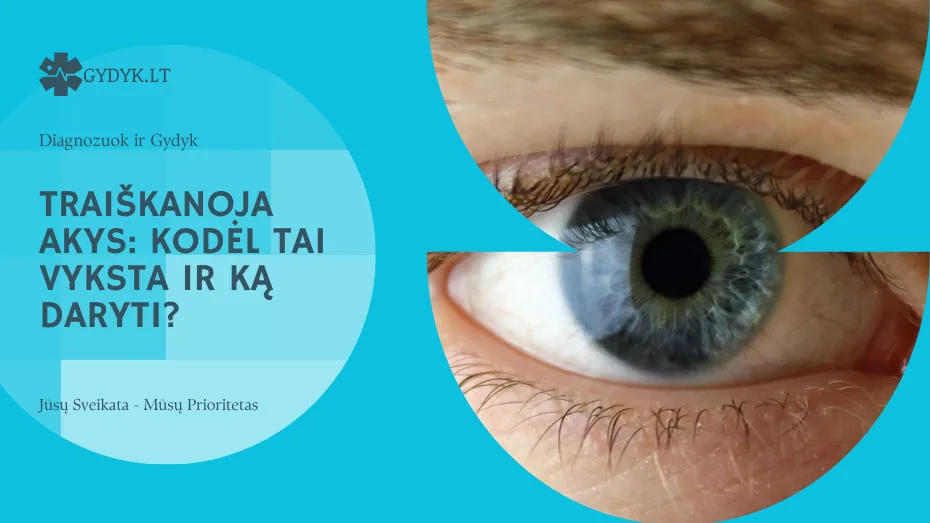 Traiškanoja akys: kodėl tai vyksta ir ką daryti?