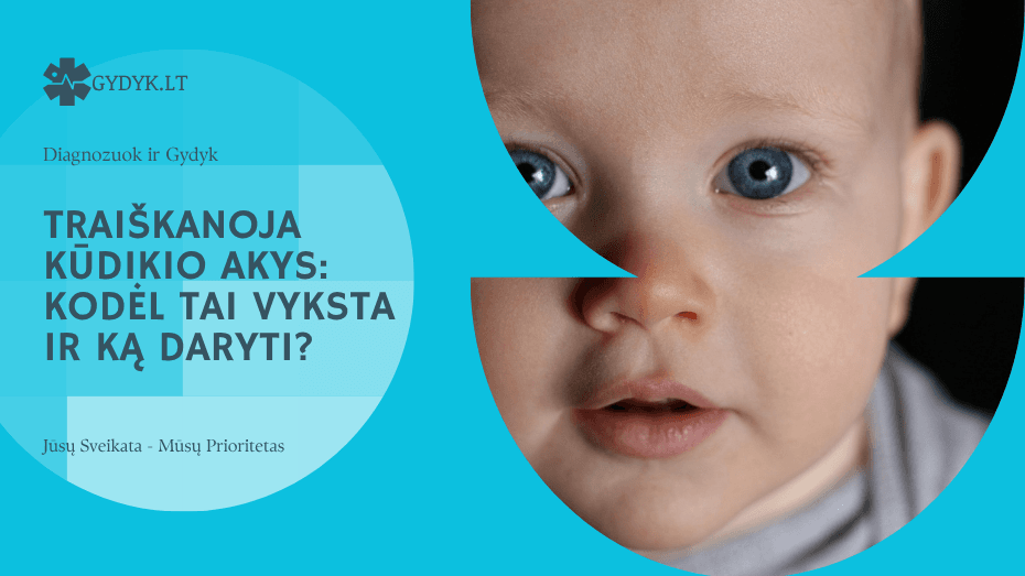 Traiškanoja kūdikio akys kodėl tai vyksta ir ką daryti