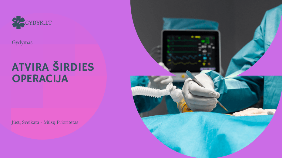 Atvira širdies operacija – rizikos, eiga ir pasveikimo procesas atvira širdies operacija