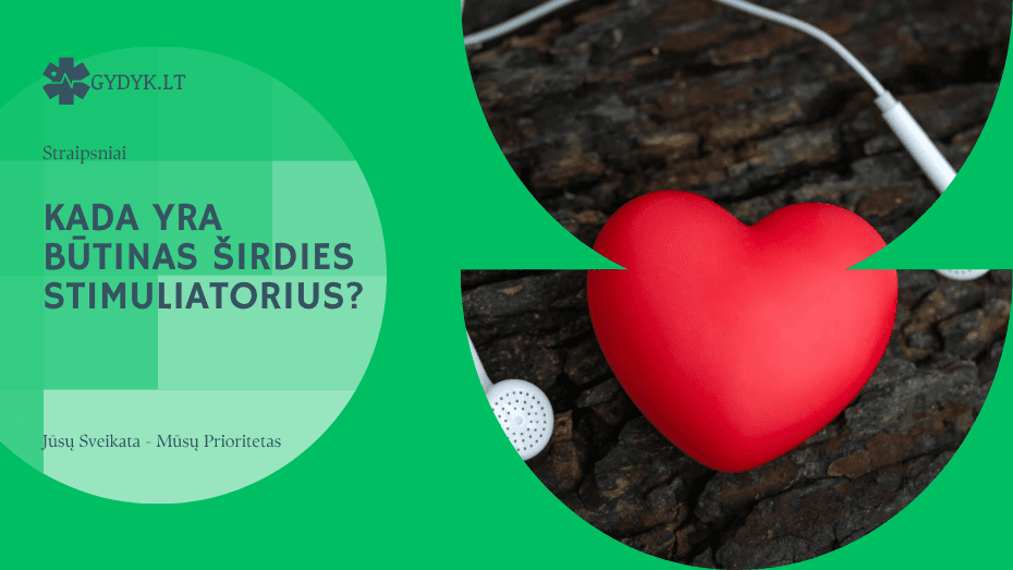 kada yra būtinas širdies stimuliatorius