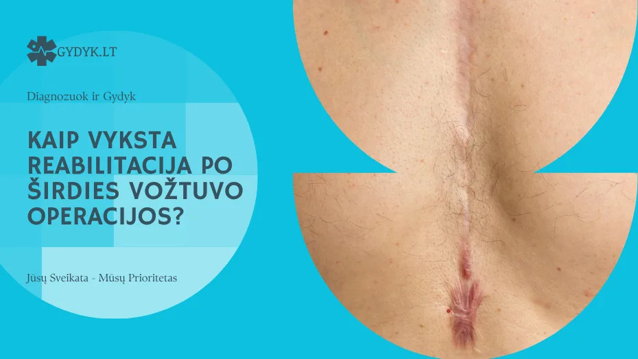 Kaip vyksta reabilitacija po širdies vožtuvo operacijos?