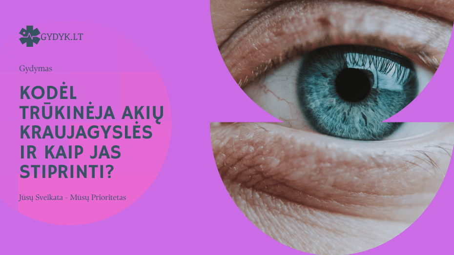 Ką daryti, kad akių baltymai būtų balti? Kodėl trūkinėja akių kraujagyslės ir kaip jas stiprinti?