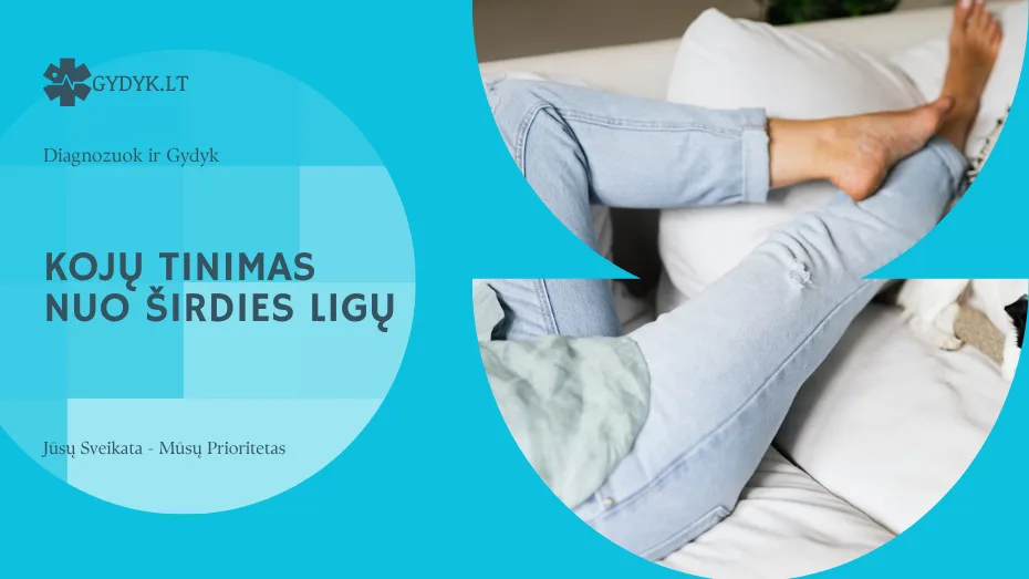 Kojų tinimas nuo širdies ligų – priežastys ir gydymo būdai
