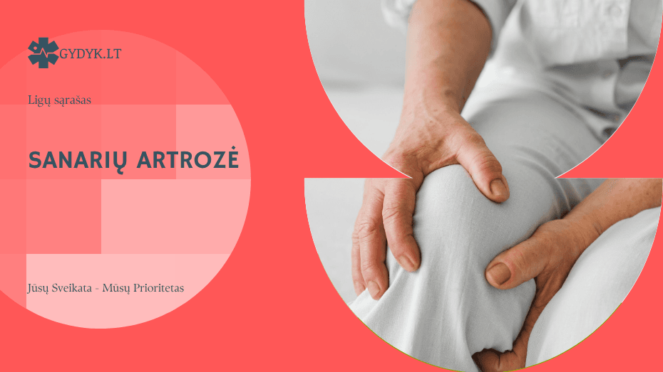sanarių artrozė