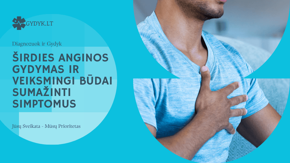 Širdies anginos gydymas ir veiksmingi būdai sumažinti simptomus Širdies anginos gydymas ir veiksmingi būdai sumažinti simptomus