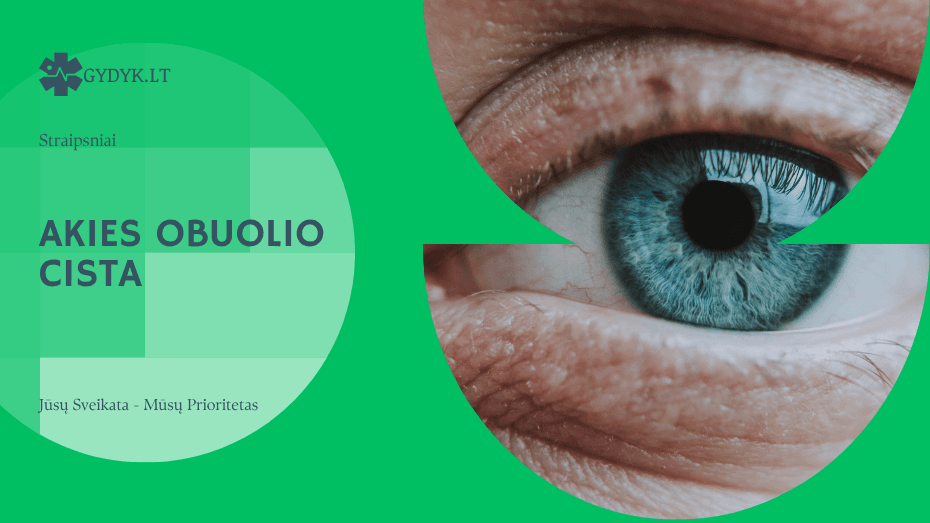 Akies obuolio cista: ar tai pavojinga ir kaip gydoma?