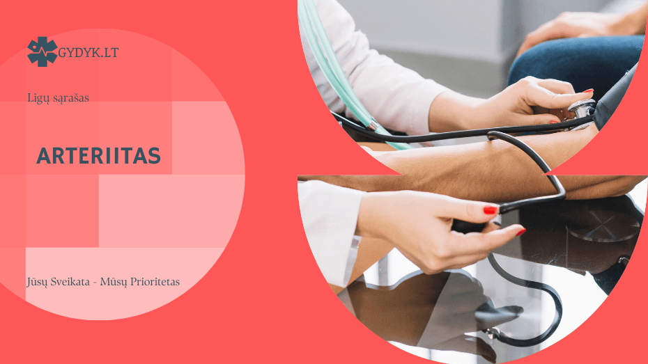 Arteriitas: kas tai, simptomai ir gydymo principai Arteriitas