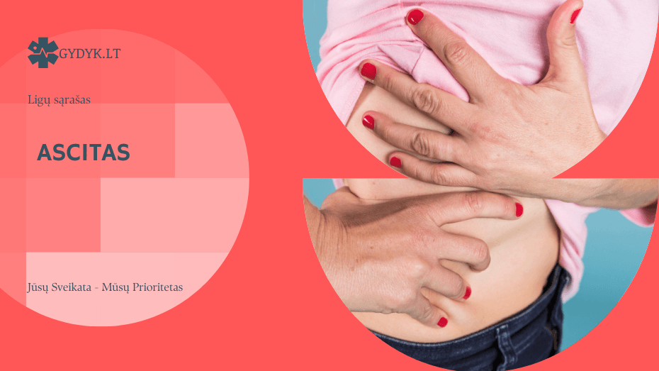 Ascitas
