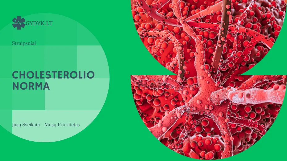 Cholesterolio norma: kokia ji turėtų būti pagal amžių ir lytį? Cholesterolio norma