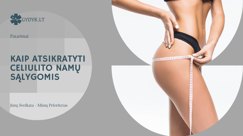 Kaip atsikratyti celiulito namų sąlygomis
