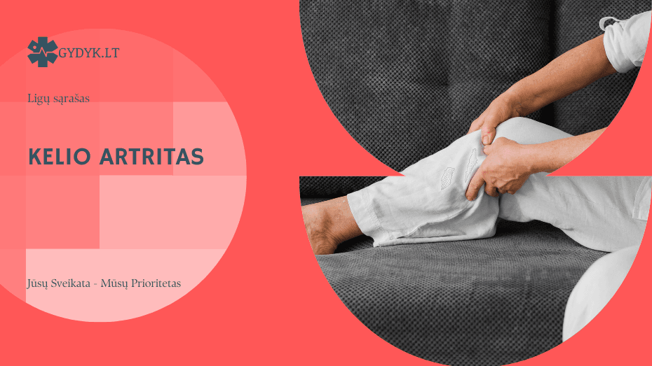 Kelio artritas: simptomai, tyrimai ir gydymo galimybės