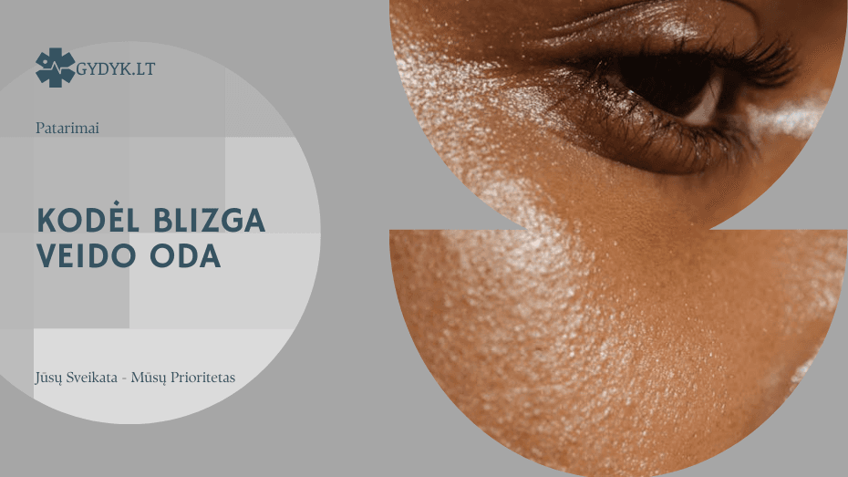 Kodėl blizga veido oda: priežastys, odos priežiūra ir gydytojų patarimai