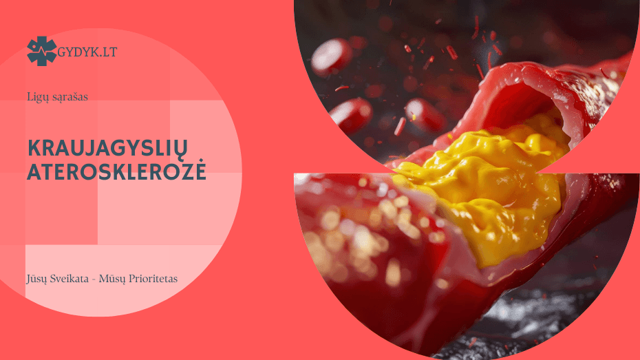 Kraujagyslių aterosklerozė