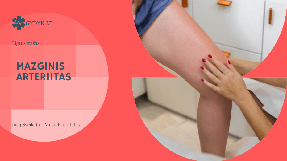 Mazginis arteriitas