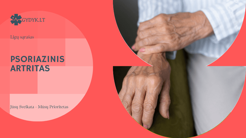 Psoriazinis artritas