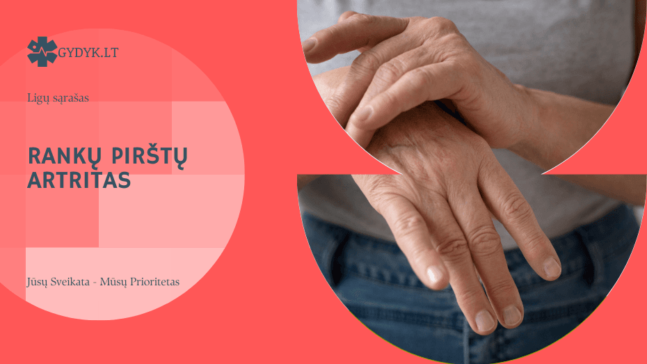 Rankų pirštų artritas: pirmieji požymiai ir gydymo būdai