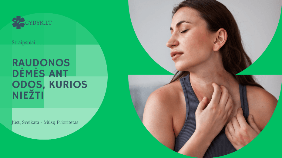 Raudonos dėmės ant odos, kurios niežti