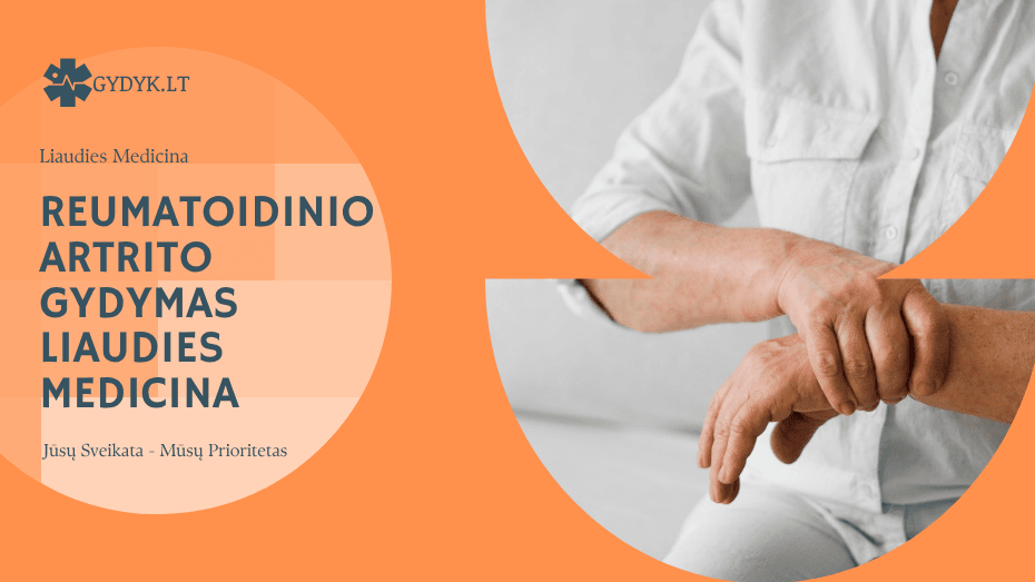 Reumatoidinio artrito gydymas liaudies medicina
