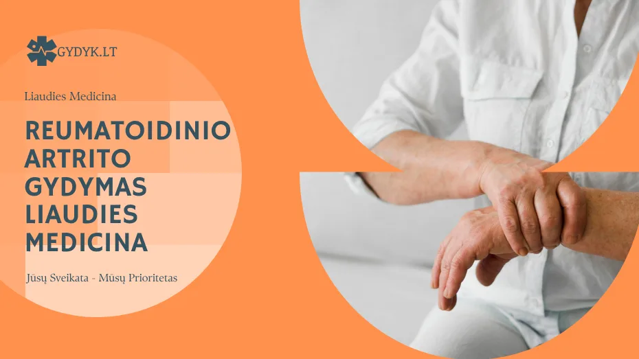 Reumatoidinio artrito gydymas liaudies medicina