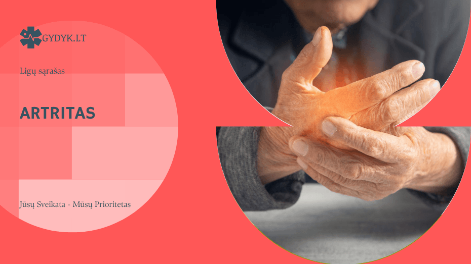 artritas