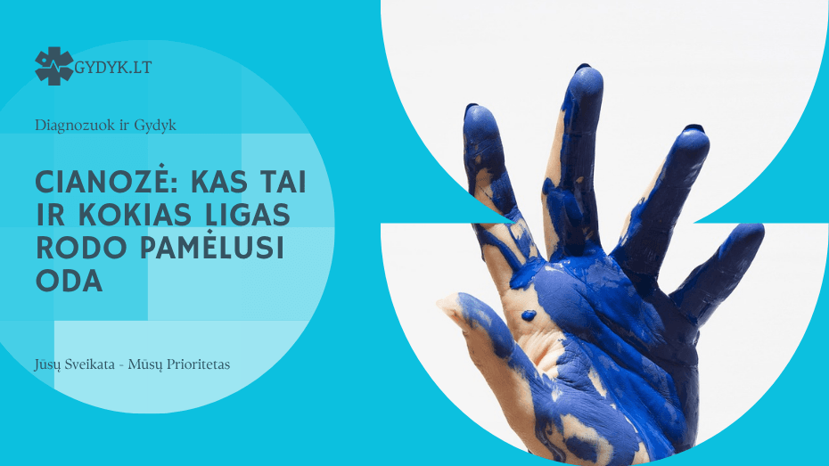 Cianozė: kas tai ir kokias ligas rodo pamėlusi oda