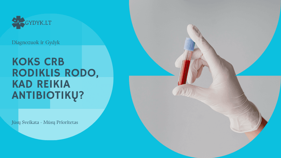 Koks CRB rodiklis rodo, kad reikia antibiotikų? Gydytojų paaiškinimas