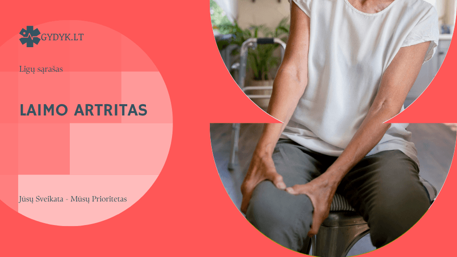 laimo artritas