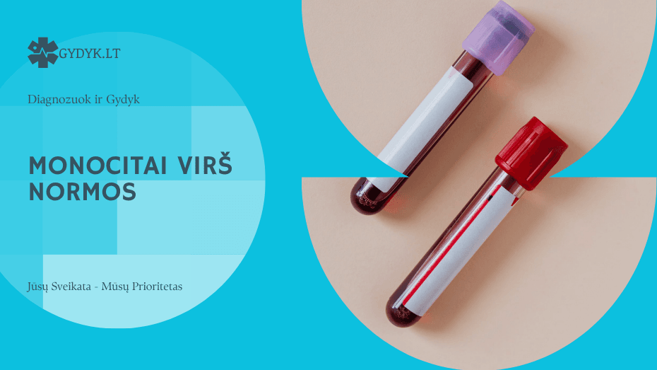 Monocitai virš normos: ką rodo kraujo tyrimo rezultatai?