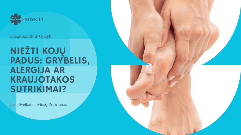 Niežti kojų padus: grybelis, alergija ar kraujotakos sutrikimai?