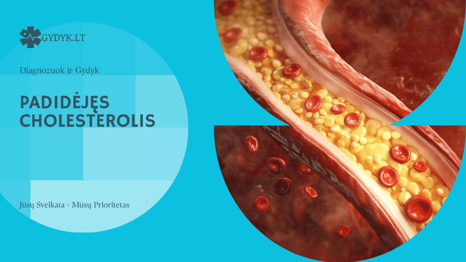 padidėjęs cholesterolis
