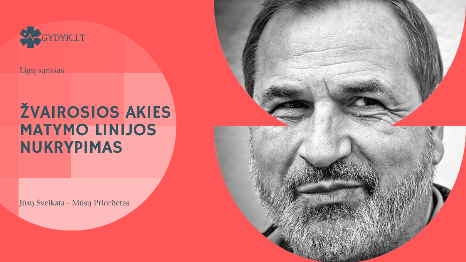 Žvairosios akies matymo linijos nukrypimas: priežastys ir gydymo galimybės