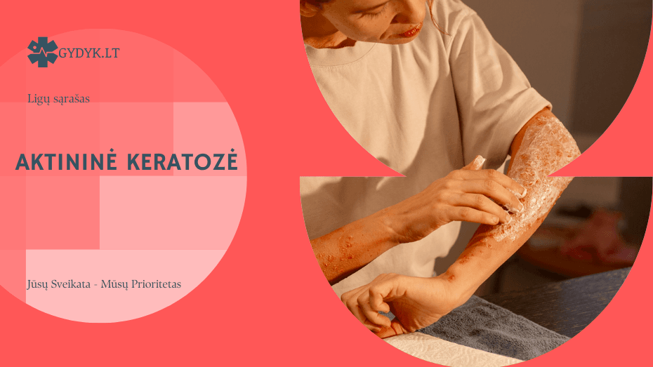 Aktininė keratozė: kas tai, simptomai, priežastys ir gydymas