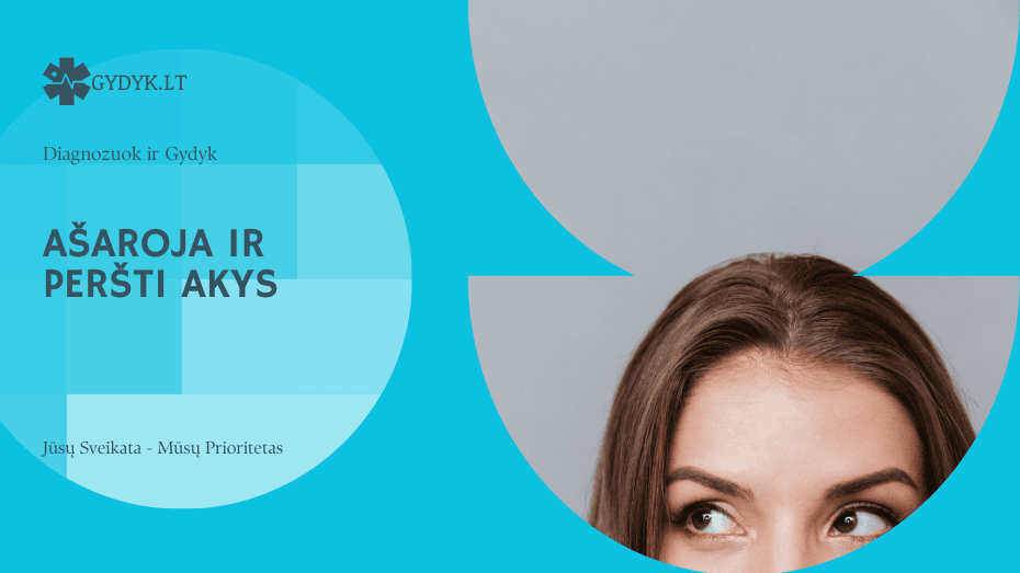 Ašaroja ir peršti akys