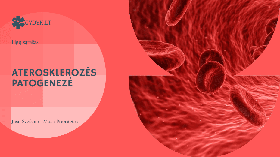 Aterosklerozės patogenezė: kaip formuojasi aterosklerozinės plokštelės