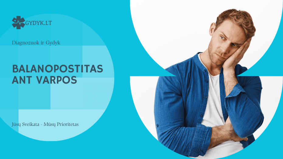 Balanopostitas ant varpos