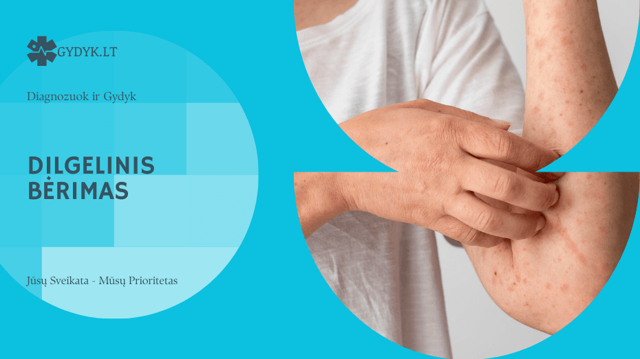 Dilgelinis bėrimas: kada tai alergija, o kada streso pasekmė?