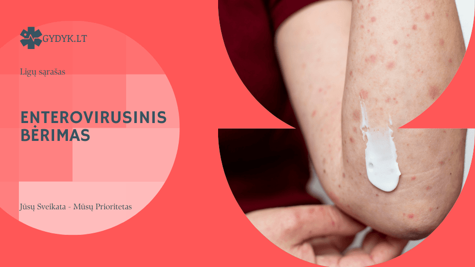 Enterovirusinis bėrimas