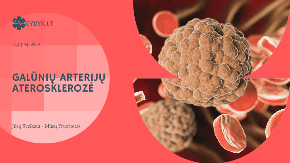 Galūnių arterijų aterosklerozė
