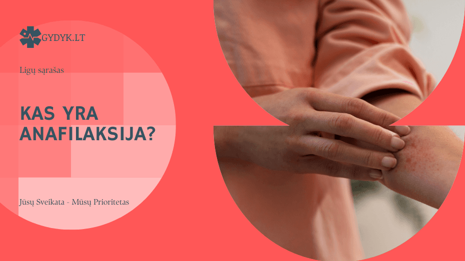 Kas yra anafilaksija