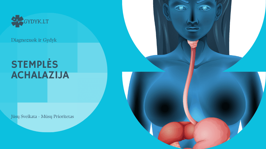 Stemplės achalazija