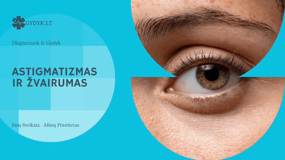 Astigmatizmas ir žvairumas: skirtumai, ryšys ir korekcijos galimybės