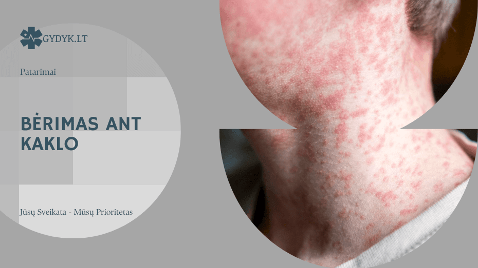 Bėrimas ant kaklo: kada tai prakaitavimas, o kada infekcija?