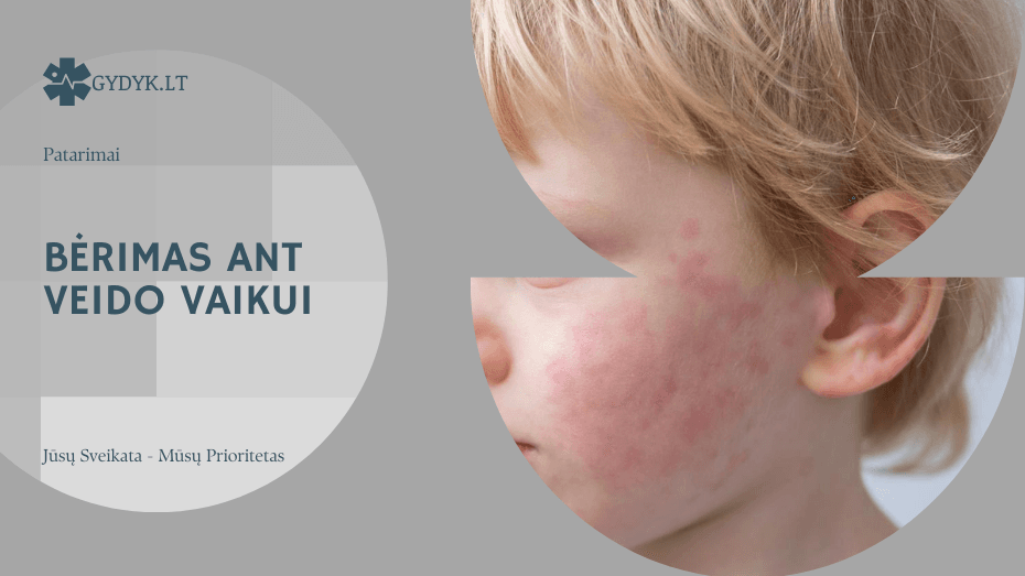 Bėrimas ant veido vaikui: alergija, virusas ar odos sudirginimas?